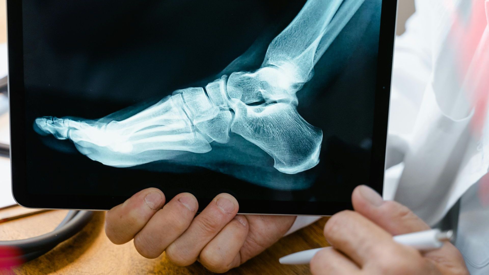 A doctor is holding a tablet with an x-ray of a foot.