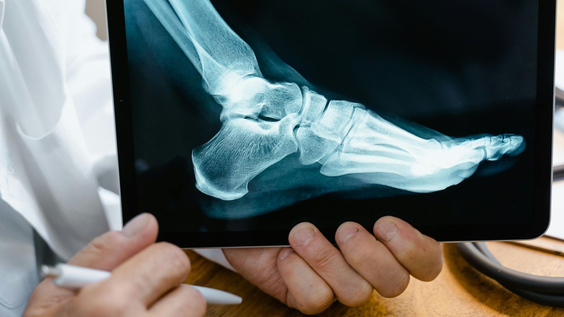 A doctor is holding a tablet with an x-ray of a foot.