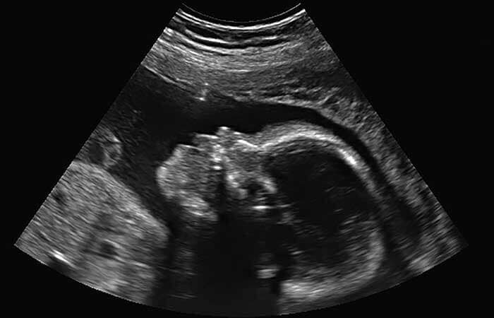 DRA. AÍDA DEL C. ESCALANTE M - GINECOLOGÍA, OBSTETRICIA Y ULTRASONIDO