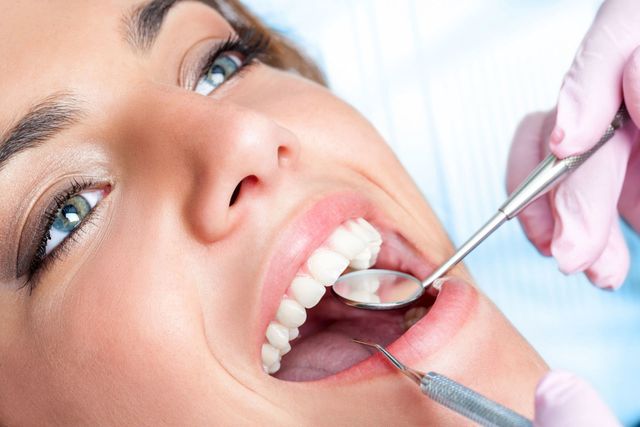 Dental Composite Bonding (Cosmetic)