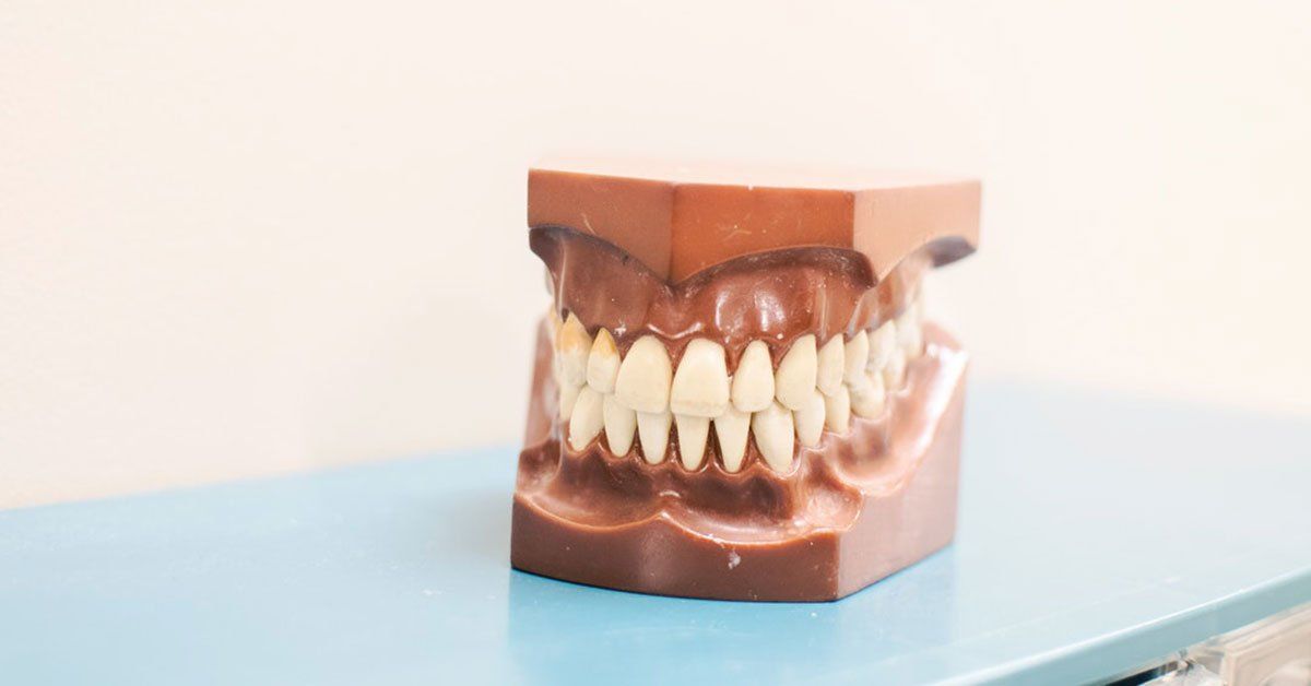 picture of dentures