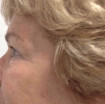 Eine Nahaufnahme des Gesichts einer Frau mit blonden Haaren.