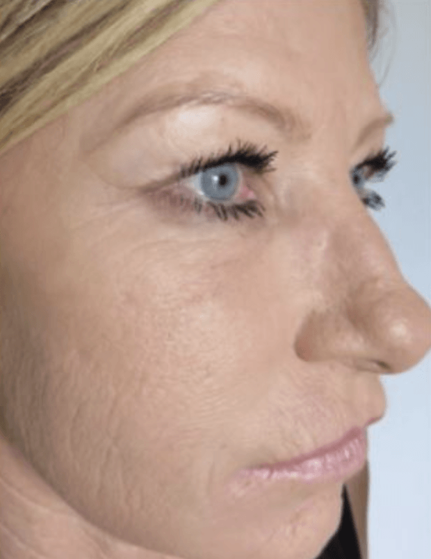 Eine Nahaufnahme des Gesichts einer Frau mit blauen Augen.