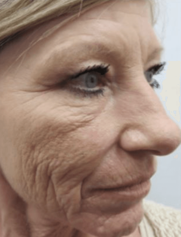 Eine Nahaufnahme des Gesichts einer Frau mit Falten