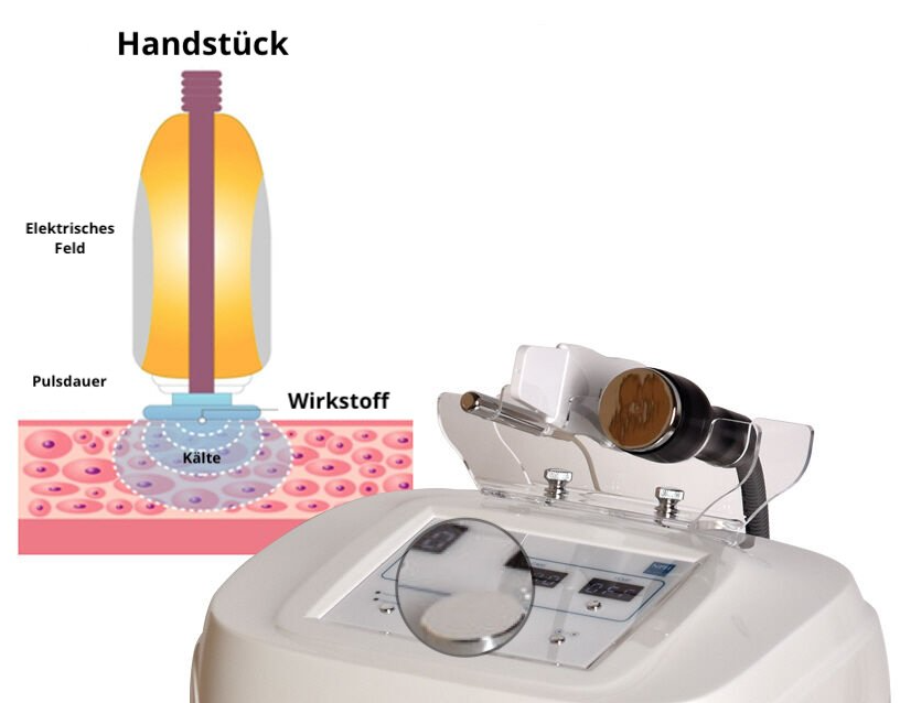 Ein Diagramm einer Maschine mit dem Wort Handstück darauf