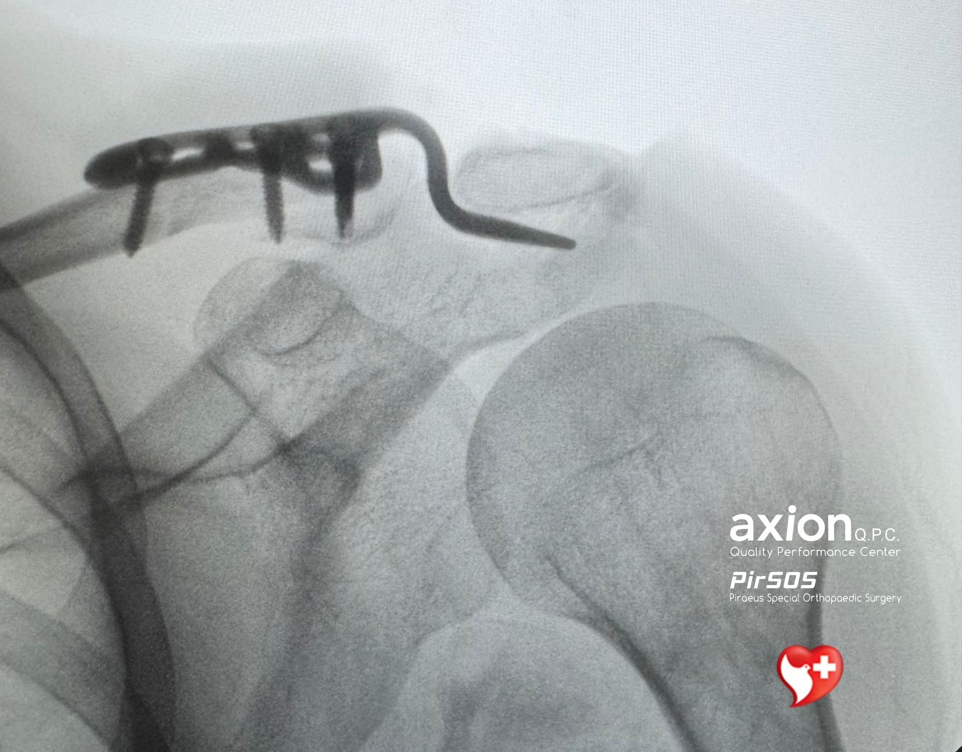 After (post-operative) image