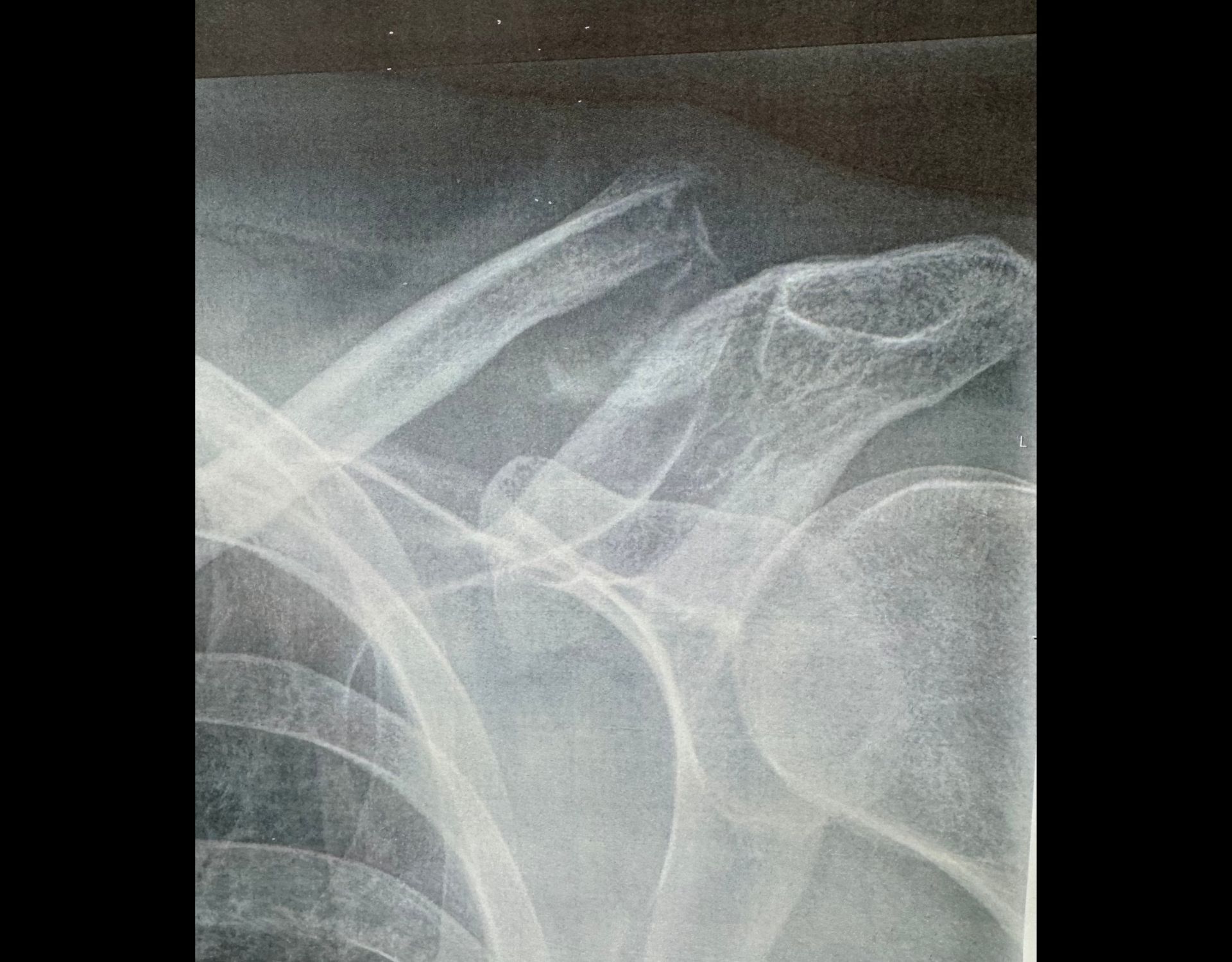 Before (pre-operative) image