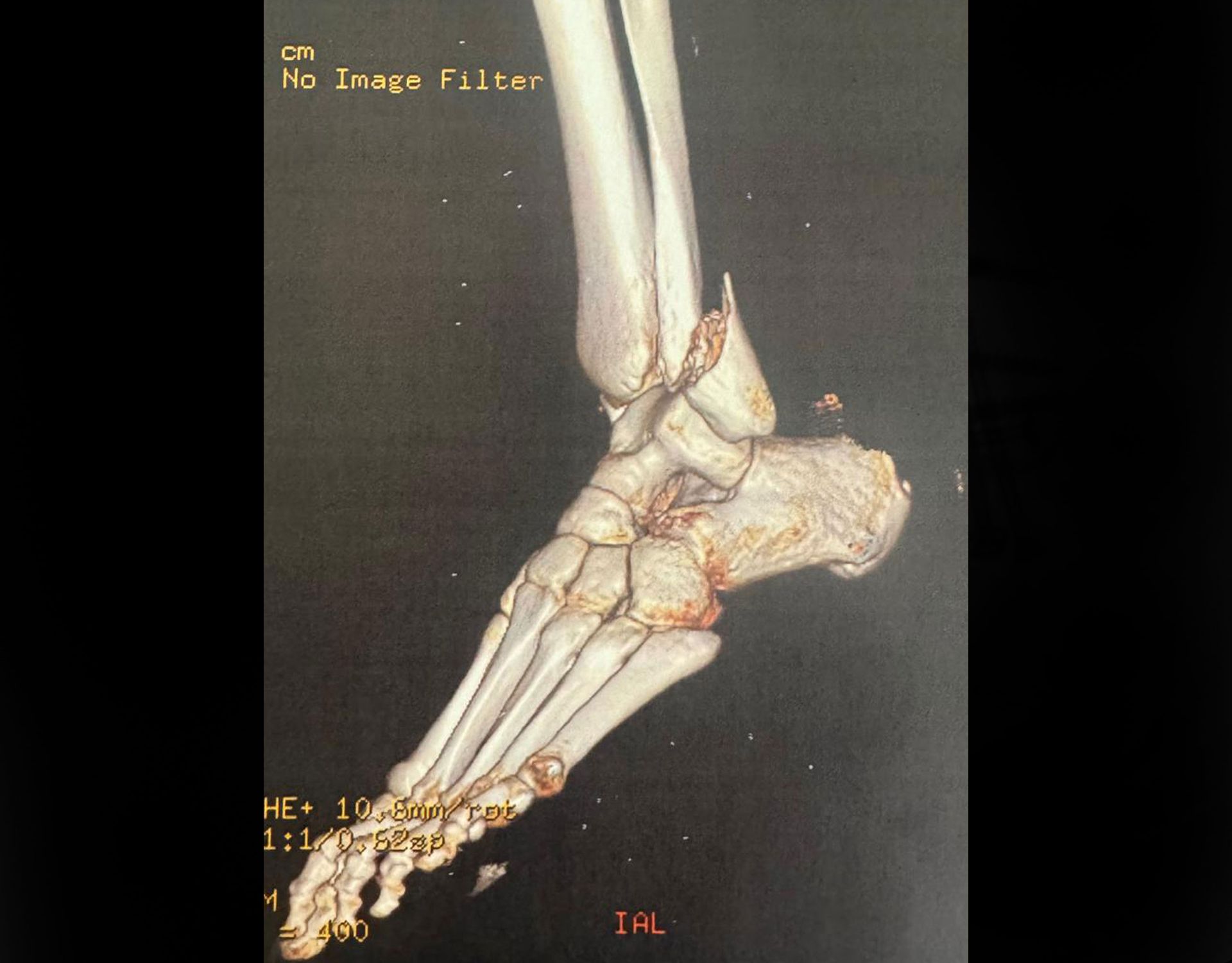 Before surgery image 1