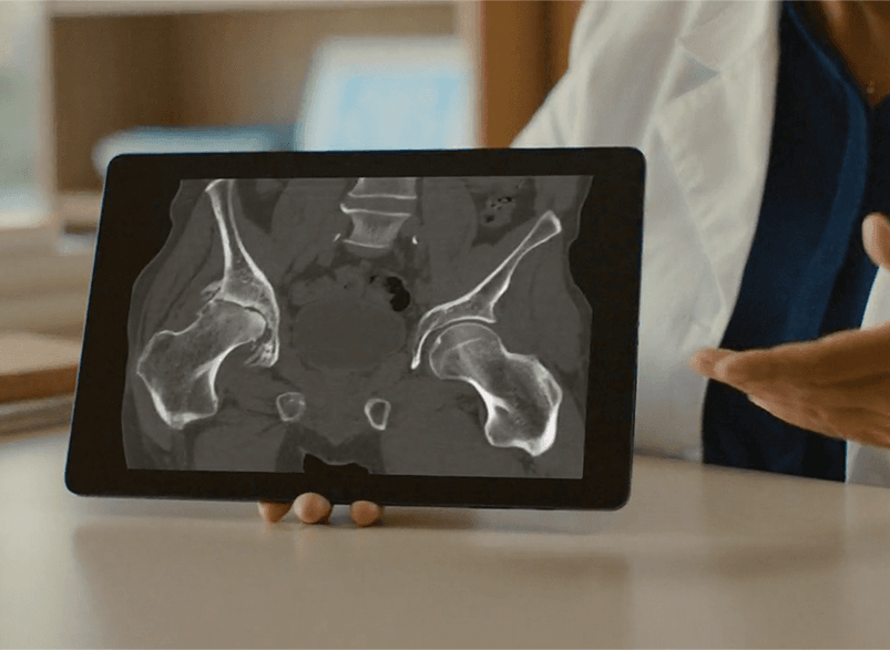 MAKO CT Scan για προεγχειρητικό σχεδιασμό
