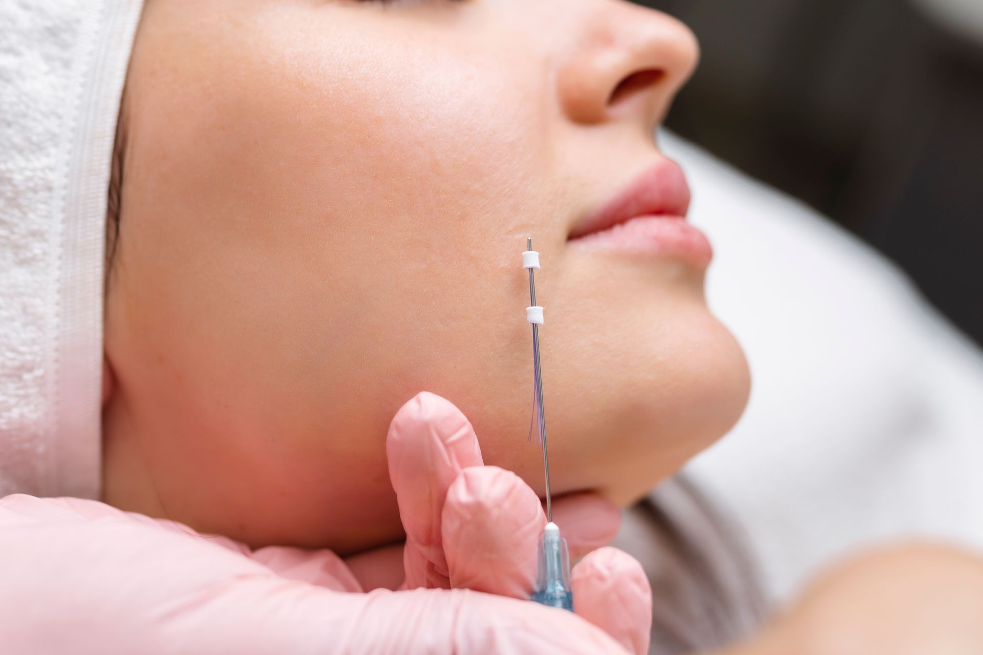 A person receiving a facial thread lift, with a needle inserted into their cheek. Pink gloved hand holds the instrument.
