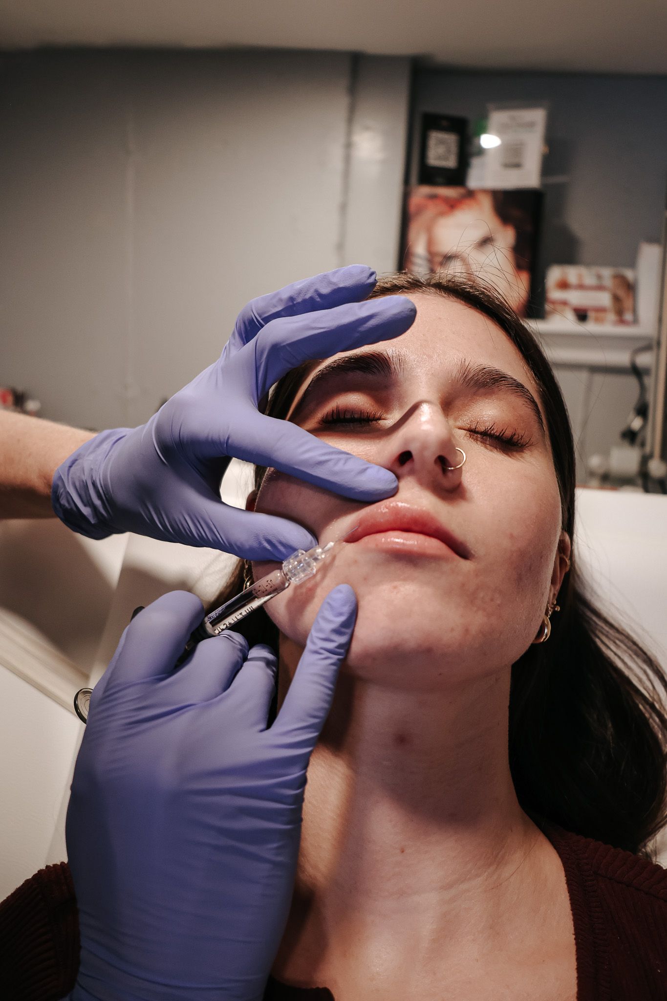 A woman is getting a botox injection in her face.