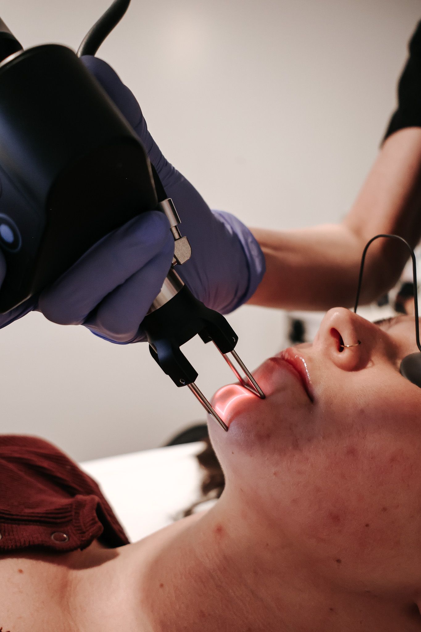 A woman is getting a laser treatment on her face.