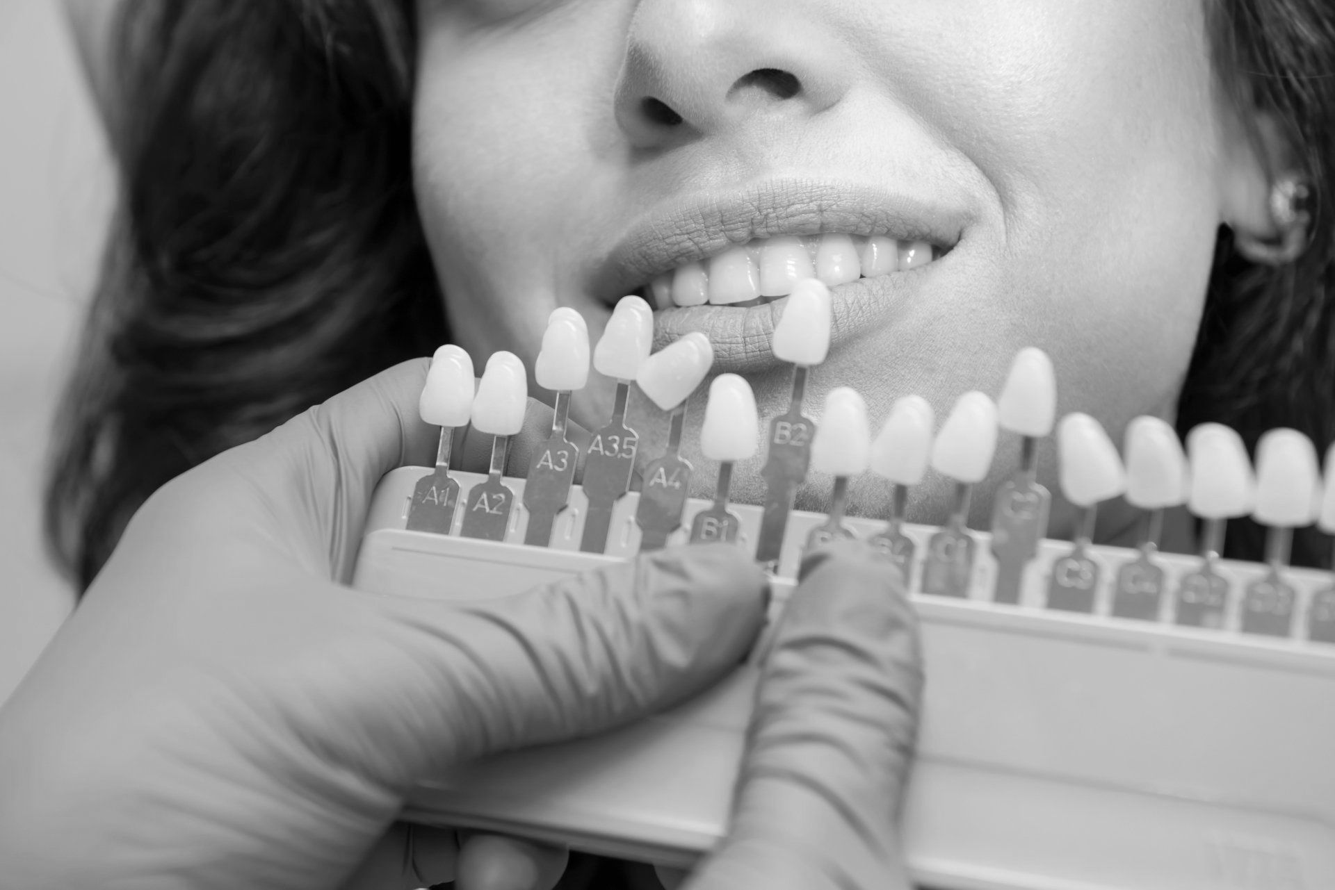 A woman is getting her teeth whitened by a dentist.