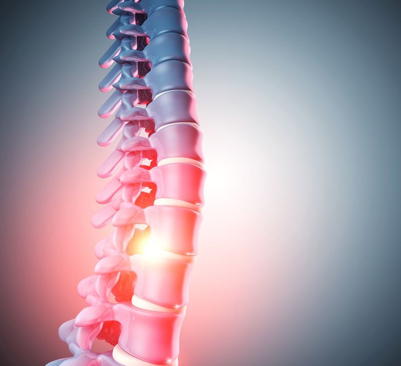 A Damaged Spine
