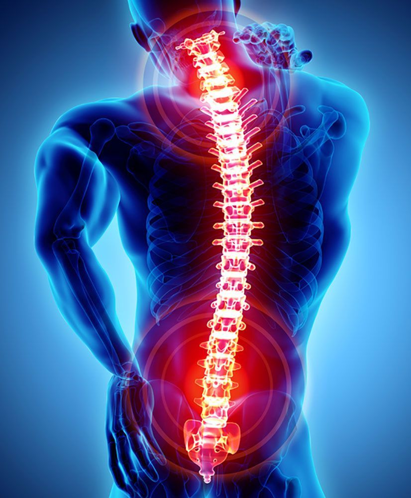Neck and back pain causes in San Antonio, Texas