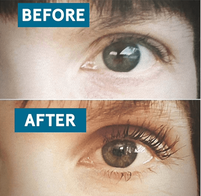 Before and After Lash Boost
