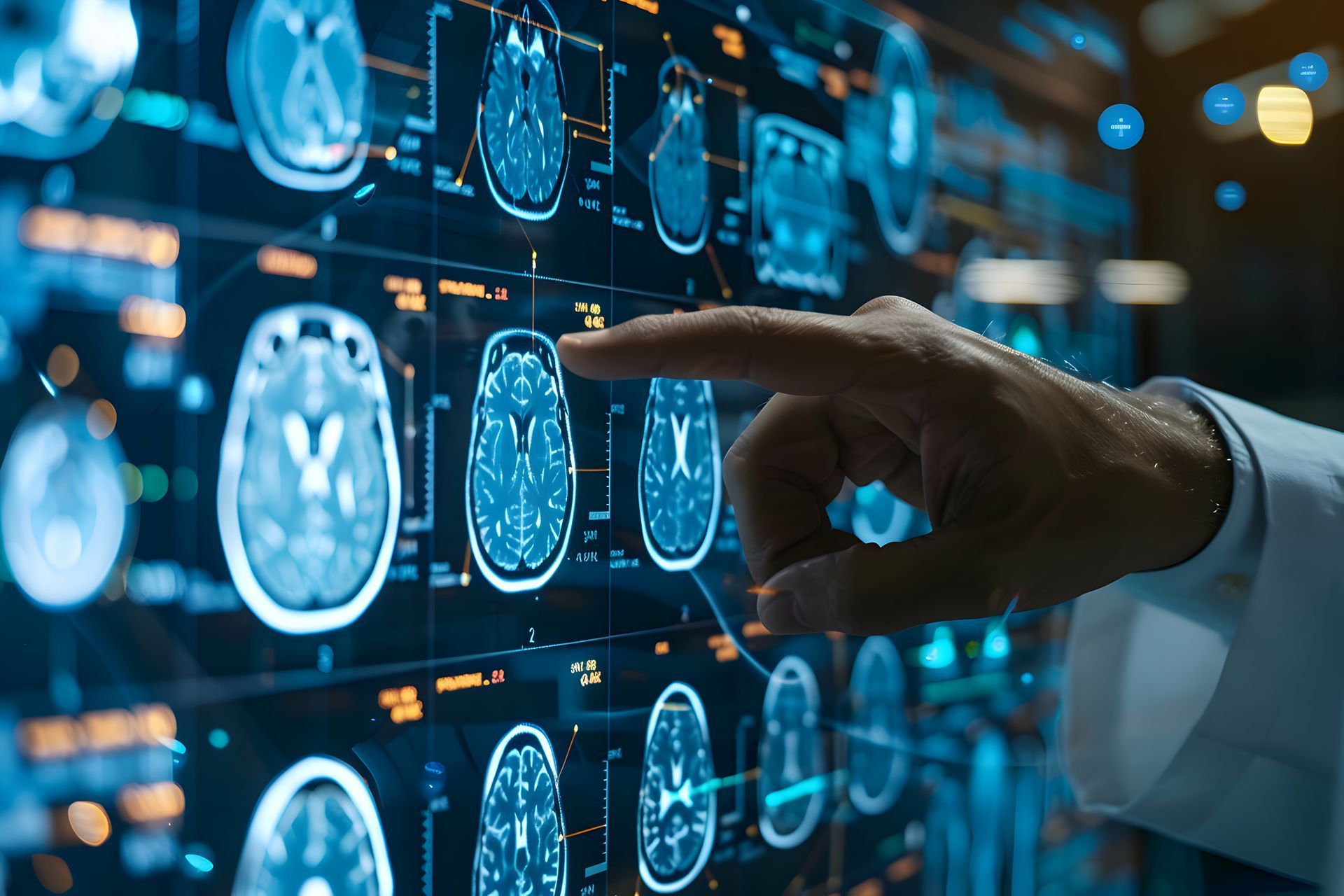 neurologist examining brain scans - tampa florida neurology specialist