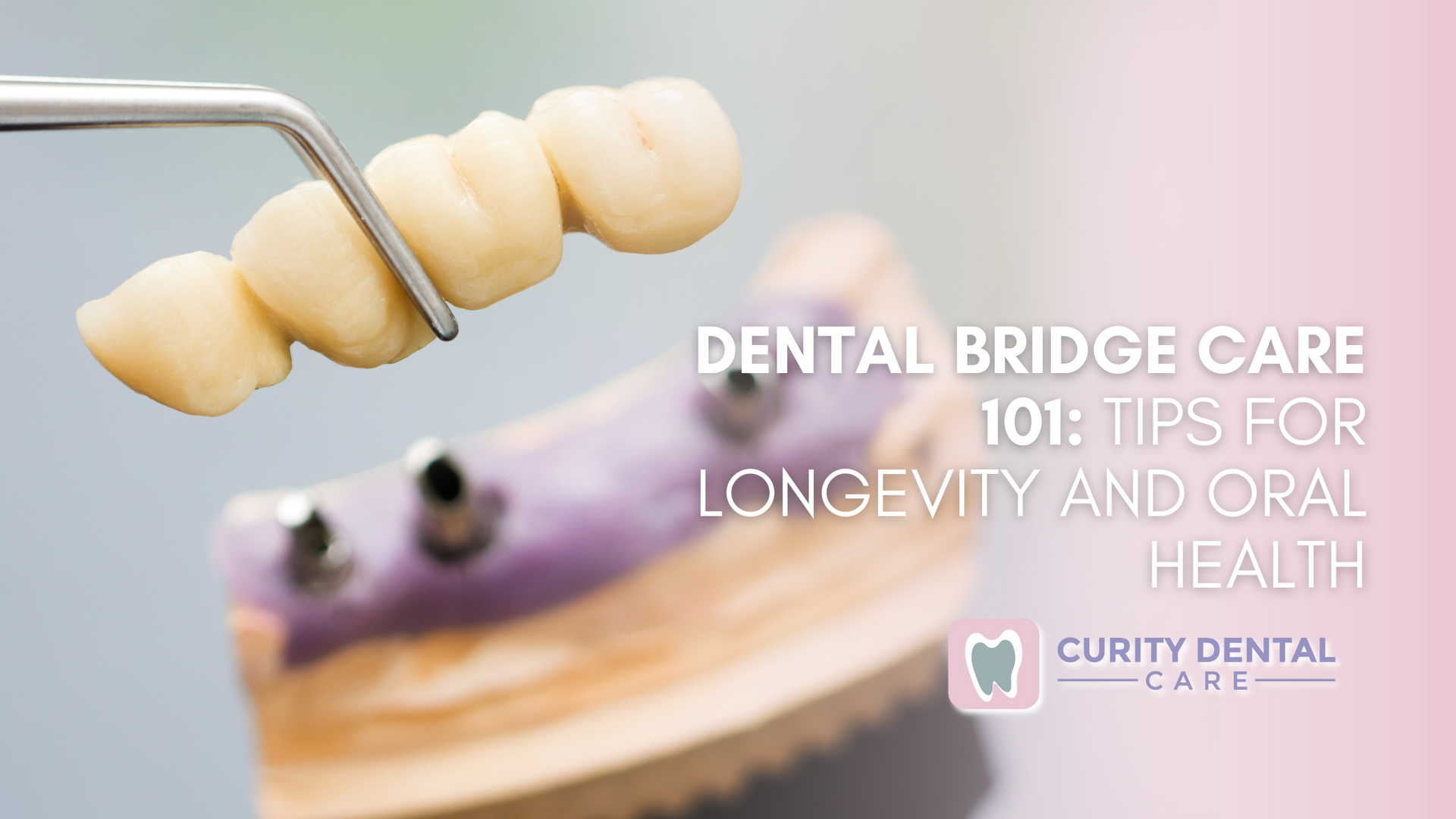 Dental bridge care 101 : tips for longevity and oral health