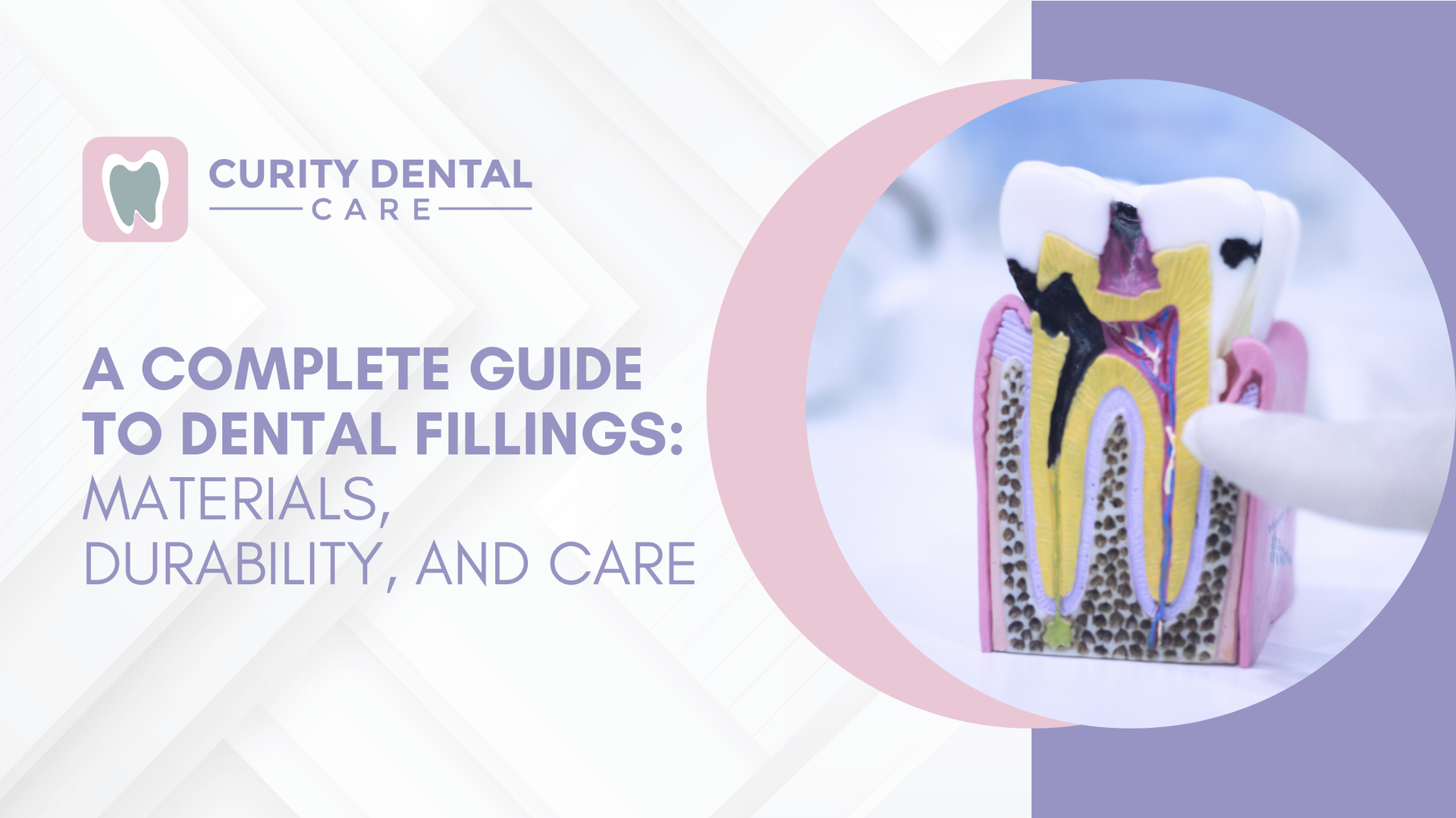 A complete guide to dental fillings : materials , durability , and care