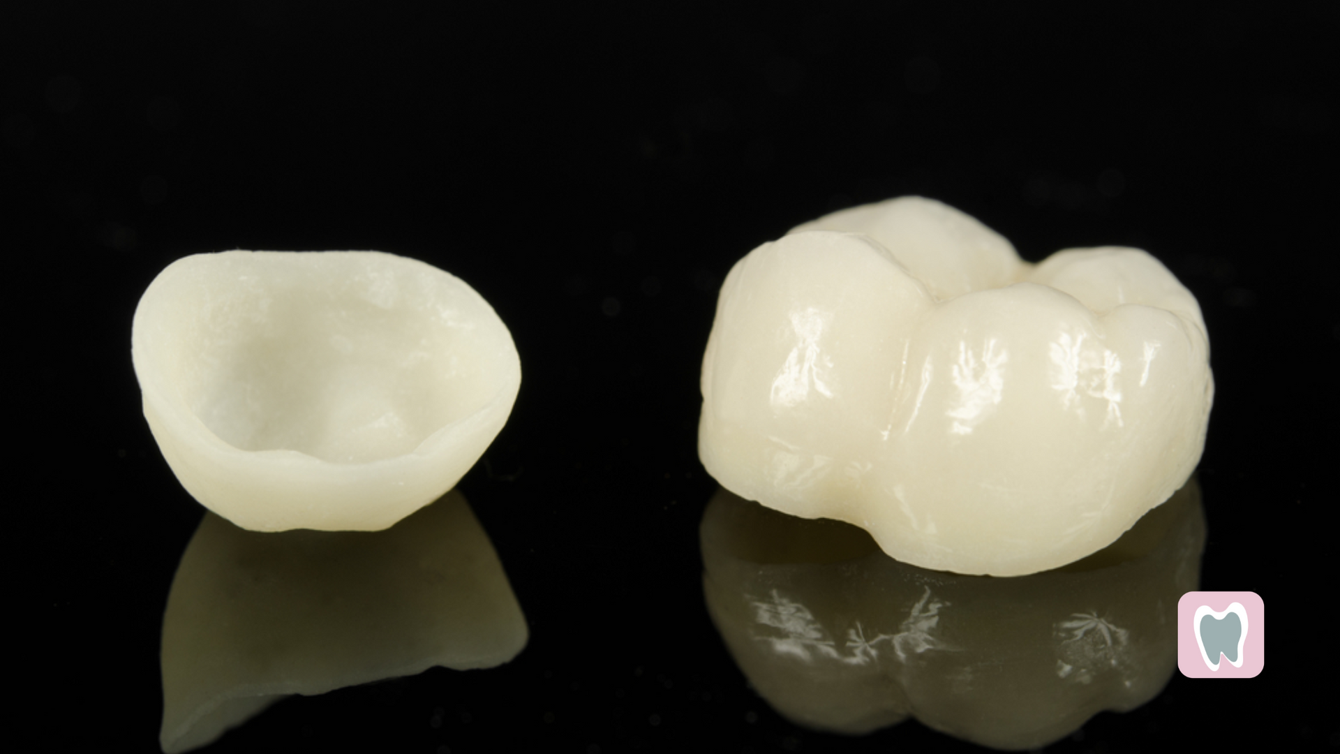 A tooth with a crown and a tooth without a crown