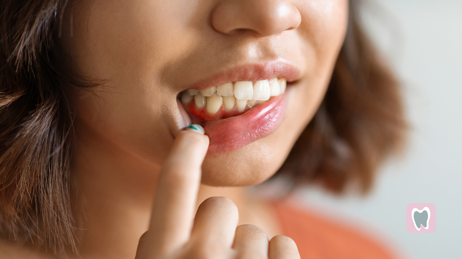 A close up of a woman 's mouth with a toothache.