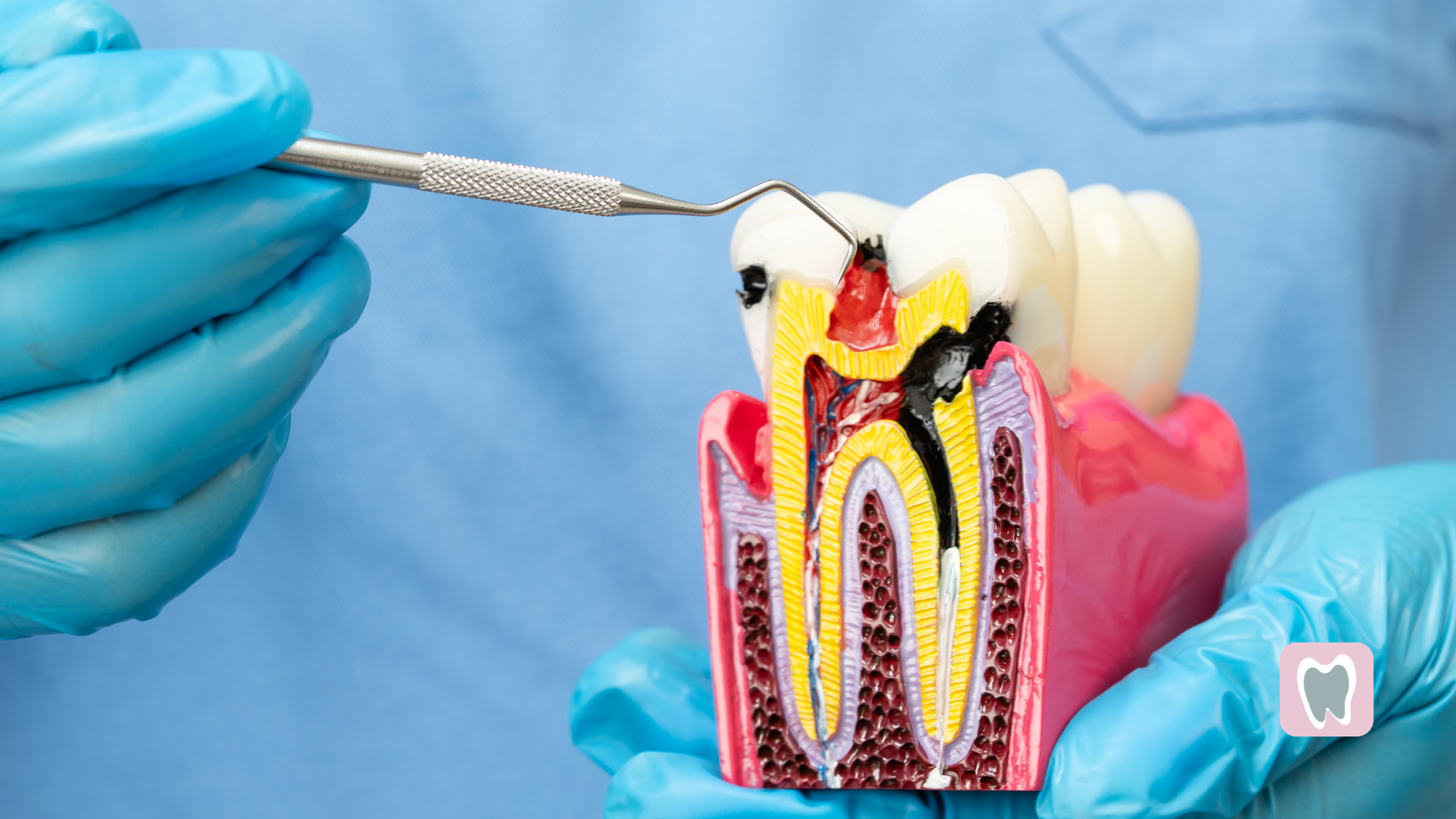 A close up of a person 's mouth with a tooth missing.