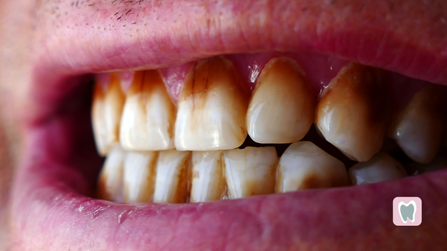 elfbar elfa master akku Does Vaping Make Your Teeth Yellow? | What Does It Do To Your Teeth?