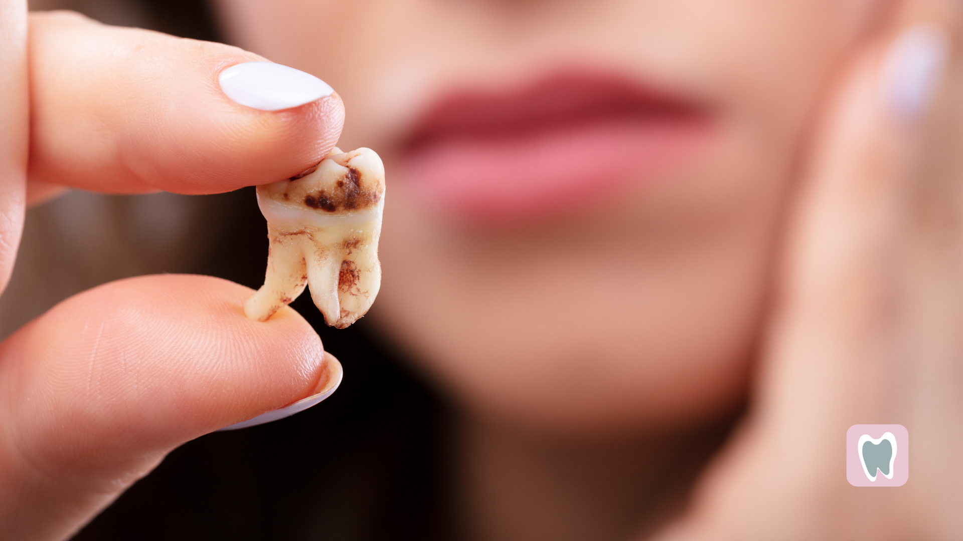 A woman is holding a tooth in her hand.