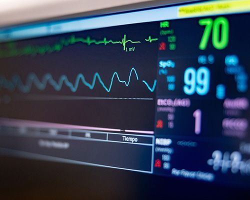 Monitores vitales
