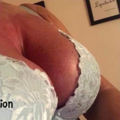 Boobs after at Vivré Skin