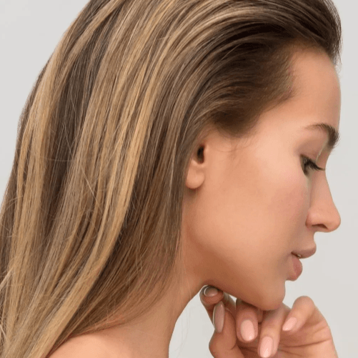 Micro Needling at Vivré