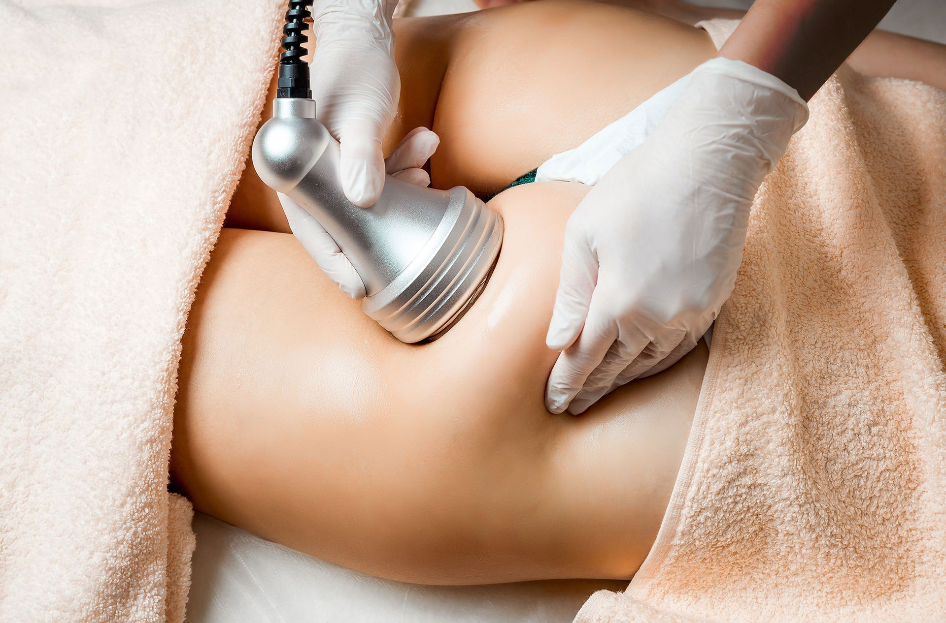 A woman is laying on a bed getting cellulite removal