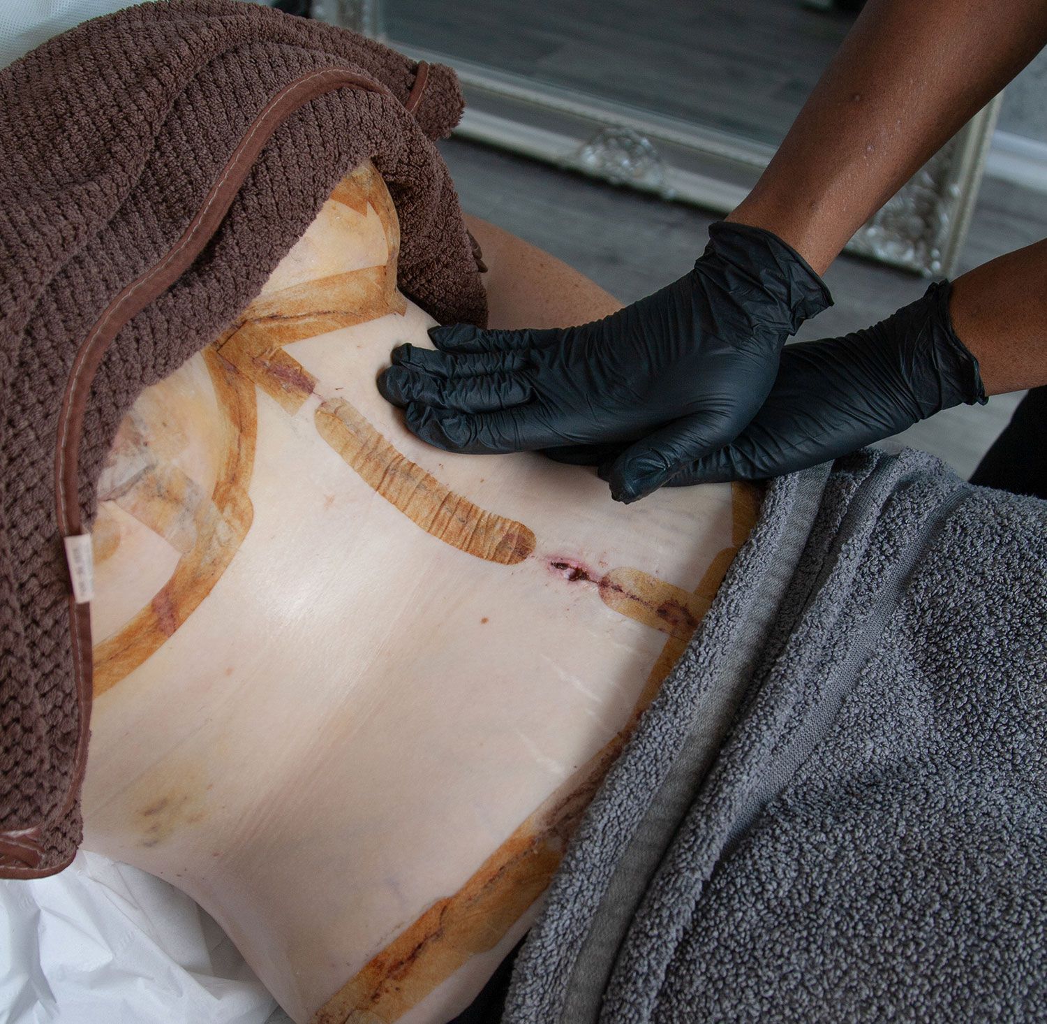 post op massage image