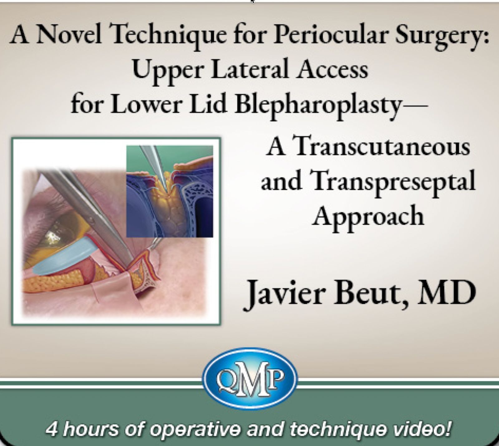 MANUAL TECNICA PERIOCULAR