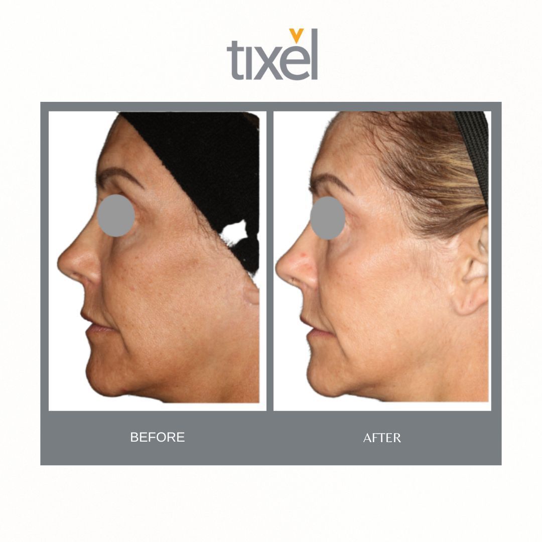 A before and after photo of a woman 's face by tixel