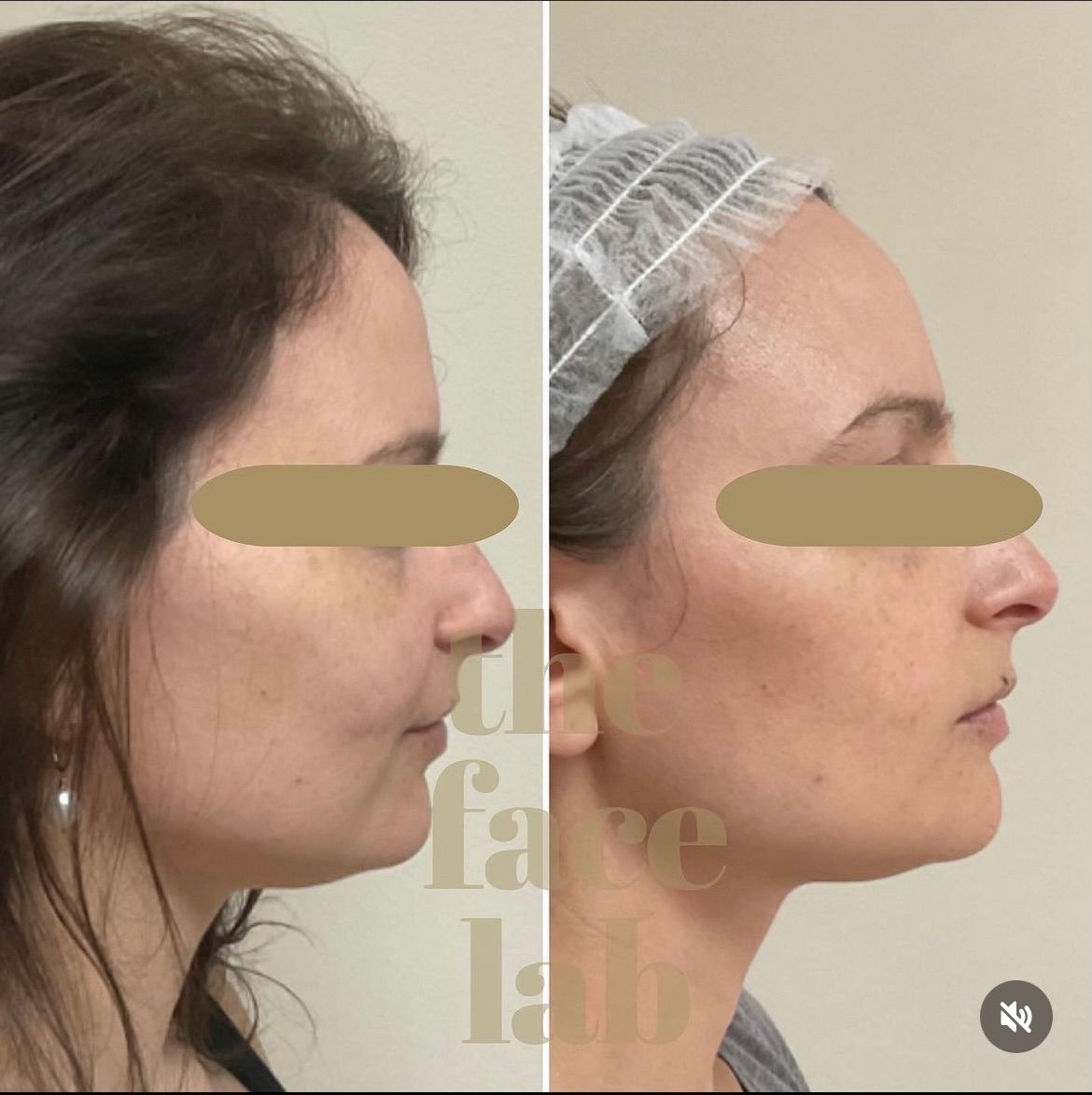 a before and after photo of a woman 's face with the words the faire lab behind her