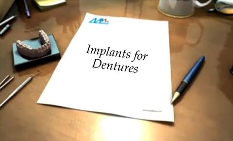 implant_denture