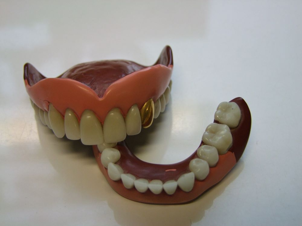 A Close Up of a Denture With a Gold Tooth on It — The Denture Kitchen in Maroochydore, QLD