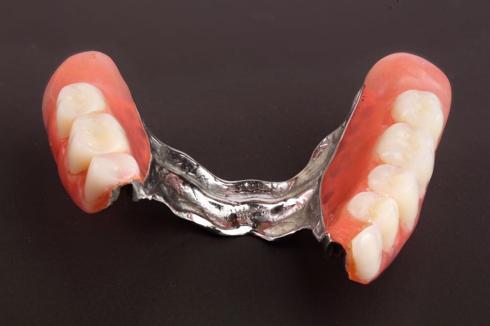 A Close Up of a Pair of Dentures on a Black Surface — The Denture Kitchen in Maroochydore, QLD