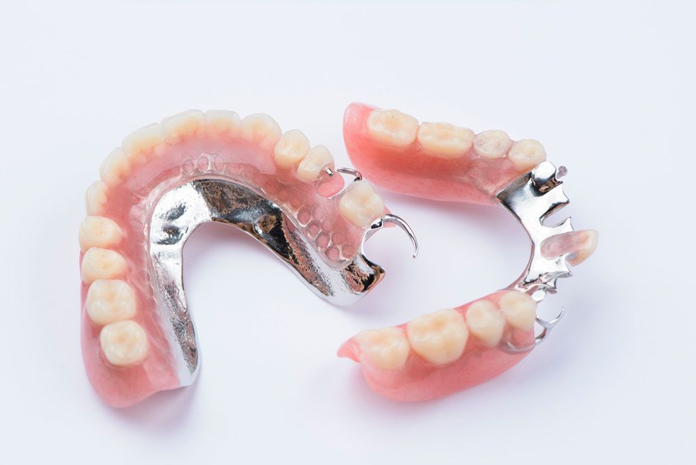 Partial Dentures On A White Table