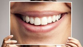 woman holding a photo of dental veneers over her face