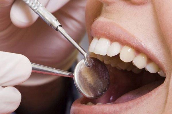 dentist checking inside mouth