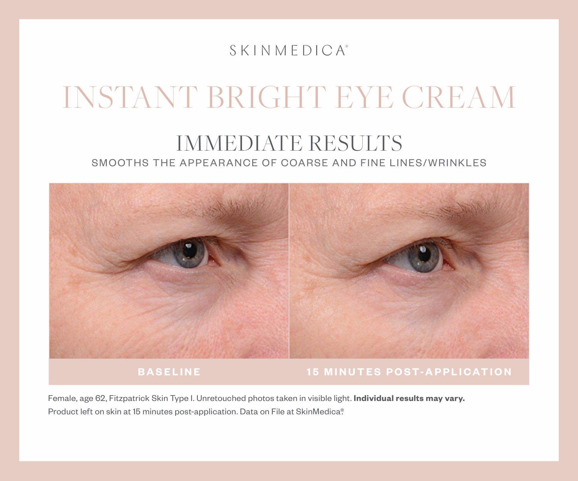 A before and after picture of a man 's eye with a cream on it.