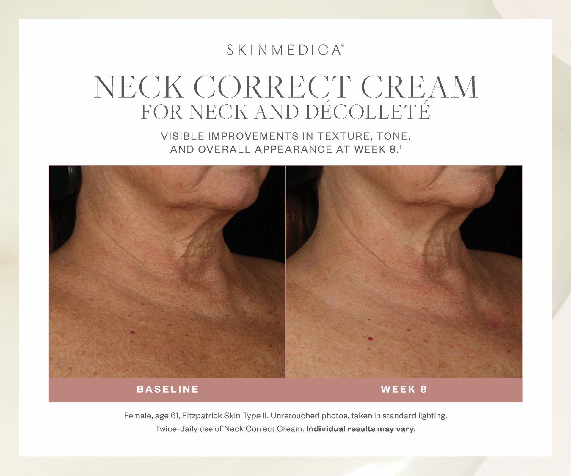 A before and after picture of a neck correct cream
