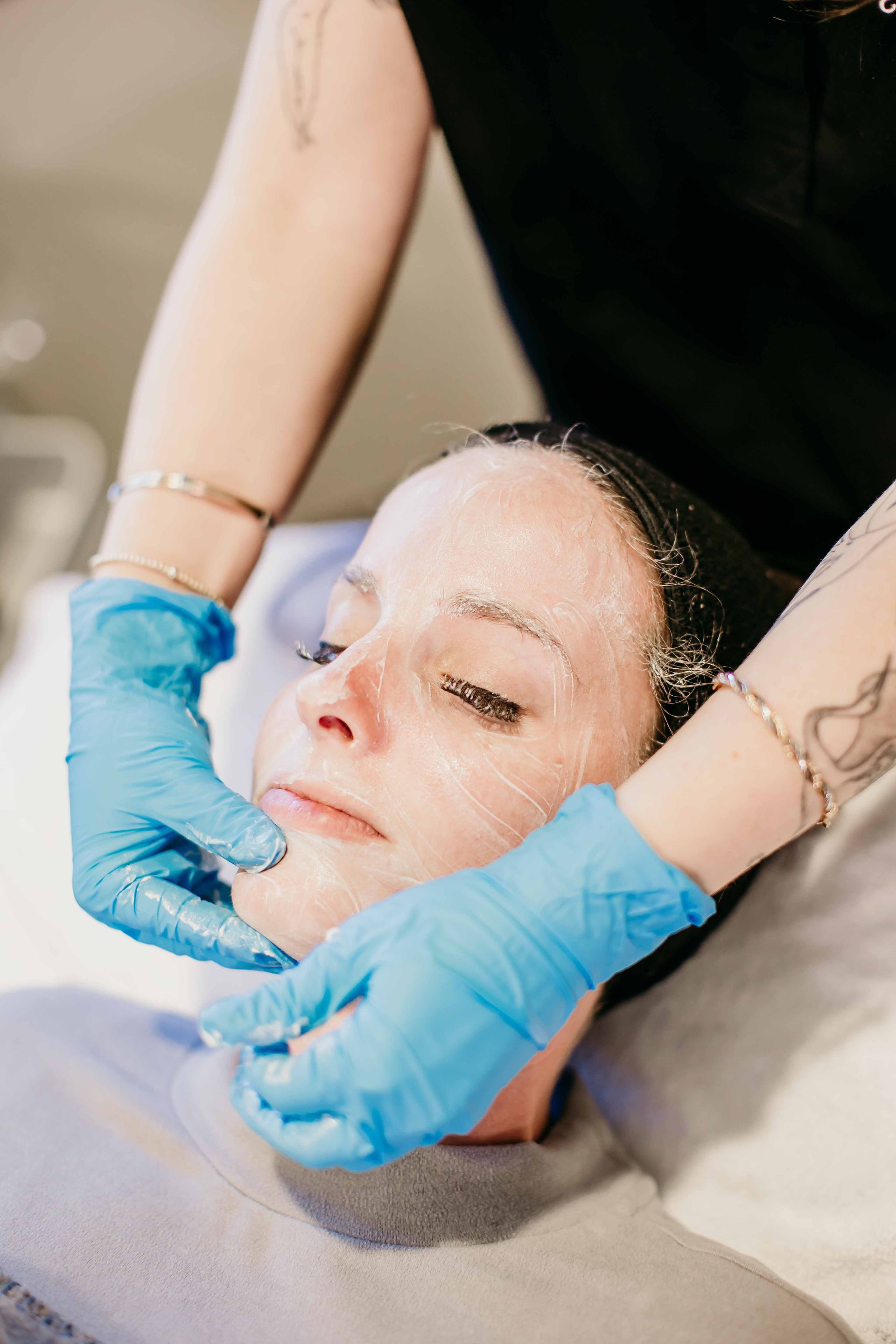 woman with lip filler injectables at Women4Women OBGYN