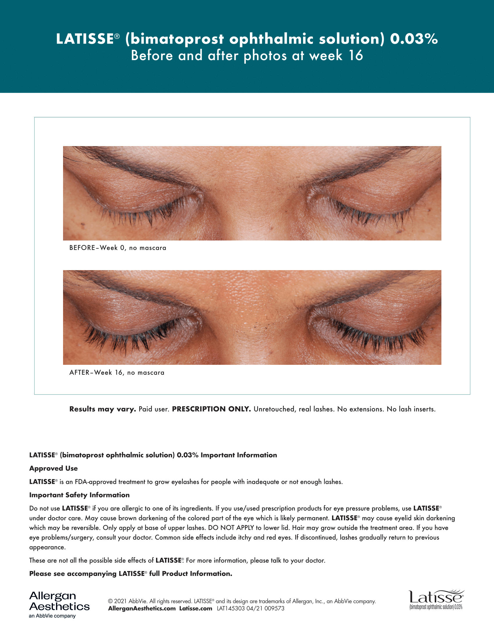 Before and After Latisse