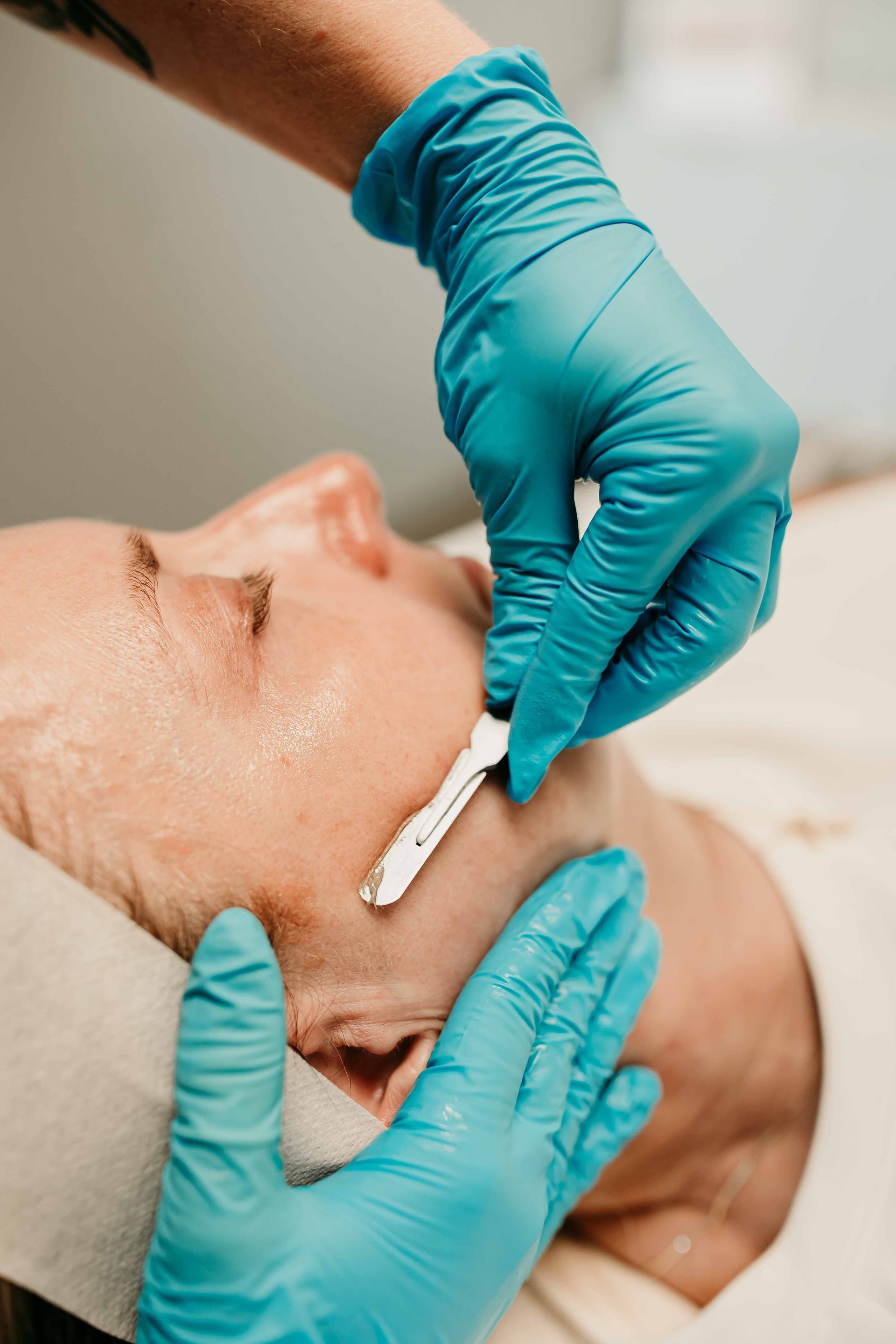Person undergoing a skincare treatment; gloved hands holding a tool near the face.