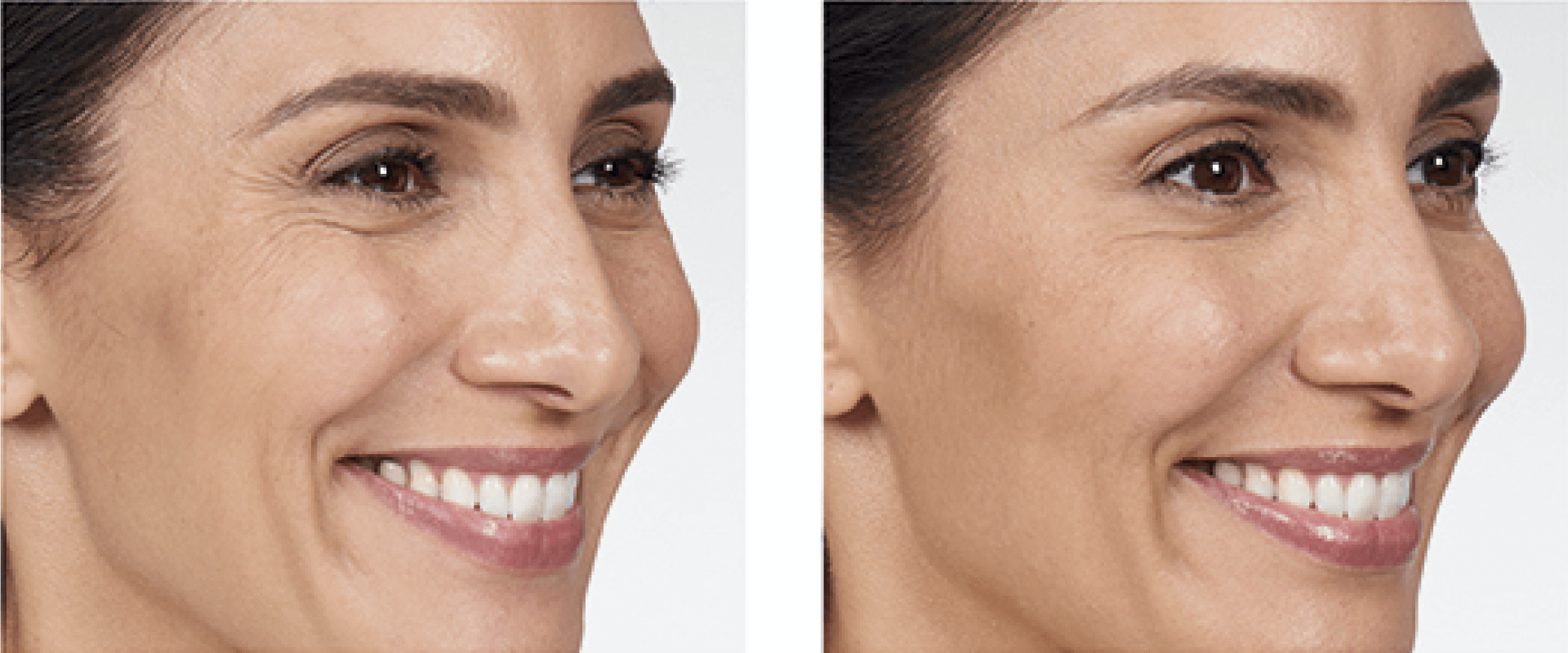 A before and after photo of a woman 's face.