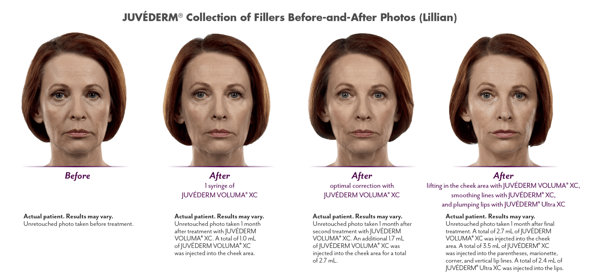 A woman 's face is shown in four different facial expressions