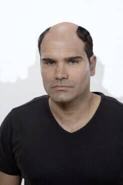 Bald Man — Philadelphia, PA — Carmine's Hair Studio